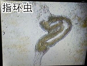 指環(huán)蟲_副本.jpg